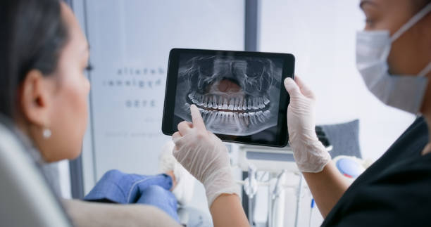 Licensed Tooth Extraction service in Union City, CA - Smile Center Dentistry